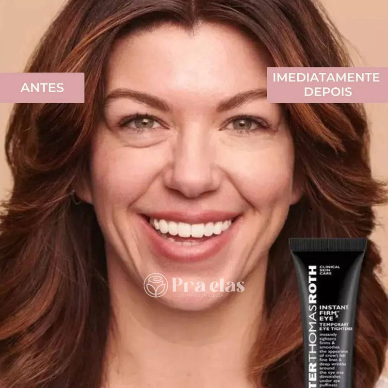 [LEVE 2 PAGUE 1] Creme Antirrugas Instantâneo Efeito Botox - (8 Horas de Duração) ®
