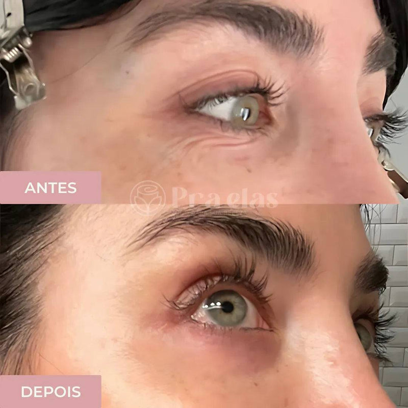 [LEVE 2 PAGUE 1] Creme Antirrugas Instantâneo Efeito Botox - (8 Horas de Duração) ®